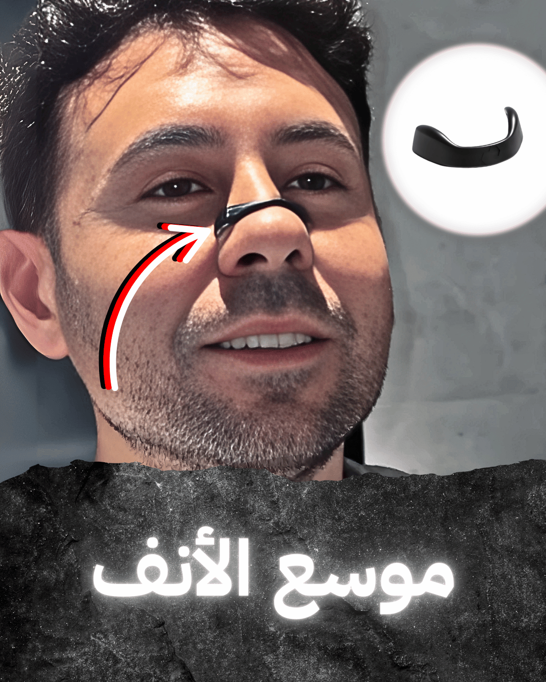 موسع الأنف المغناطيسي